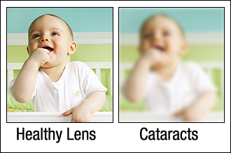 Cataract_Scene